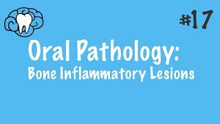 Odontogenic Keratocyst  Clinical Radiographic and Histopathologic Features [upl. by Spitzer]