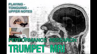 MRI Trumpet Playing Experiment [upl. by Lleznol]