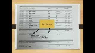 Iron Deficiency Anemia  How to read its lab results [upl. by Petulia]