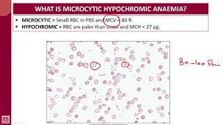 Hematology  1  U7L1  Introduction to microcytic hypochromic anaemias [upl. by Santiago255]