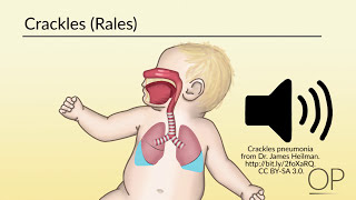 Respiratory Assessment by B Leary L DelSignore  OPENPediatrics [upl. by Benyamin]