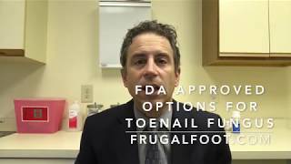 FDA Approved Options For Toenail Fungus [upl. by Adnarrim974]