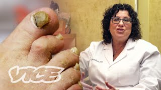 Meet a Toenail Fungus Expert [upl. by Hephzibah]