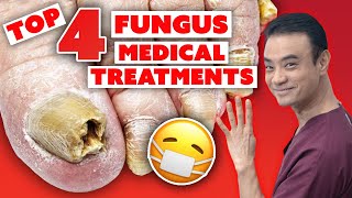 4 MEDICAL treatments to get rid of toenail fungus  Holistic Toenail Fungus Cures Part 3  Dr Kim [upl. by Bekha]