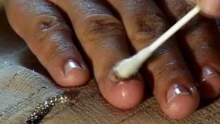 How to Cure Nail Fungus [upl. by Nnylyram]