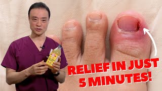 6 HOME REMEDIES To Treat A PAINFUL Ingrown Nail  Dr Kim [upl. by Cheatham]