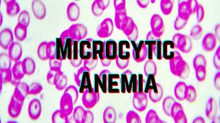 Microcytic Anemia updated 2021  CRASH Medical Review Series [upl. by Llehsyt]