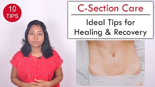 10 Tips to help Heal C Section wound  Post Delivery Care [upl. by Hobbs]