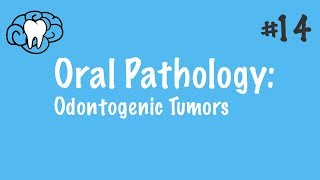 Oral Pathology  Odontogenic Tumors  INBDE ADAT [upl. by Aracat]