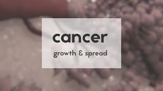 Cancer growth amp spread [upl. by Winnie]