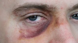 Black Eye Makeup SFX Beginners Tutorial [upl. by Lough641]