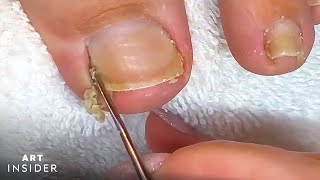 How Toenails Are Professionally Cleaned [upl. by Anilam]