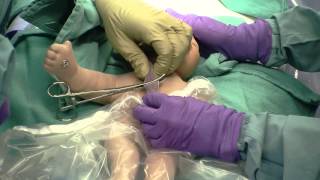 Delayed Cord Clamping [upl. by Serolod]