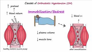 Orthostatic Hypotension Described Concisely [upl. by Ennayllek]