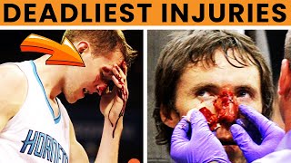 10 Worst NBA Injuries of alltime [upl. by Westmoreland]