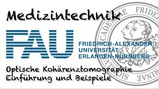 Medizintechnik  Optische Kohärenztomographie [upl. by Okorih83]